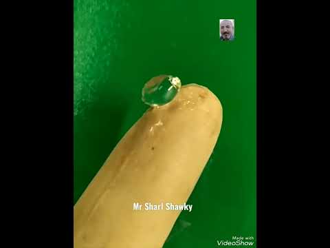 عدسة العين للاستاذ شارل شوقى