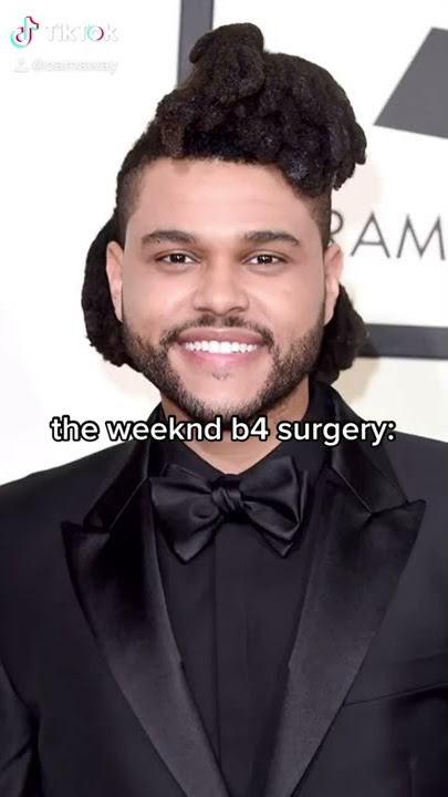 The Weeknd’s Plastic Surgery Before and After! (MUST WATCH) | tiktok edition 😭‼️ read description