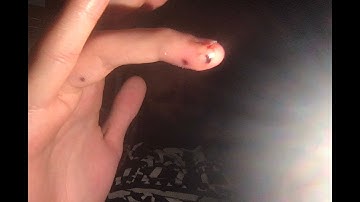 xG3 Implantable Bio-magnet from Dangerous Things