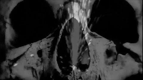 SPK : A Heart That Breaks (In No Time or Place)