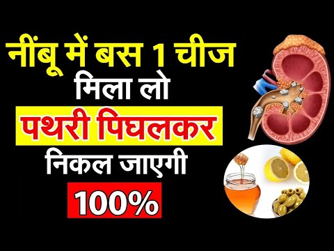 नींबू में बस 1चीज मिला लो पथरी पिघलकर निकल जाएगी देखकर चौंक जाएंगे - R1| Roshan Zindagi