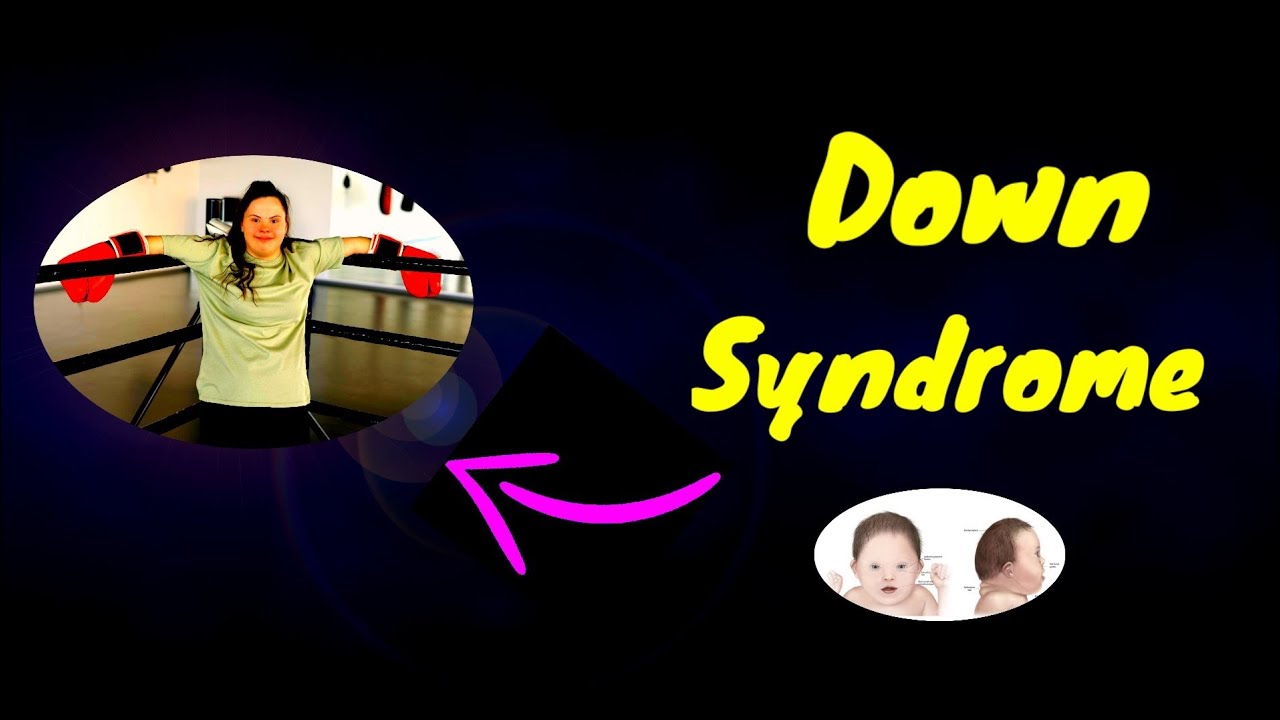what is down syndrome YouTube