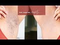 SUGARING MY ARMPITS IN 3 MINS | underarm hair removal routine