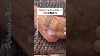 How To Remove Dead Skin 💯✅/Remove Suntan #shorts #skincare #deadskin #youtubeshorts #ytshorts