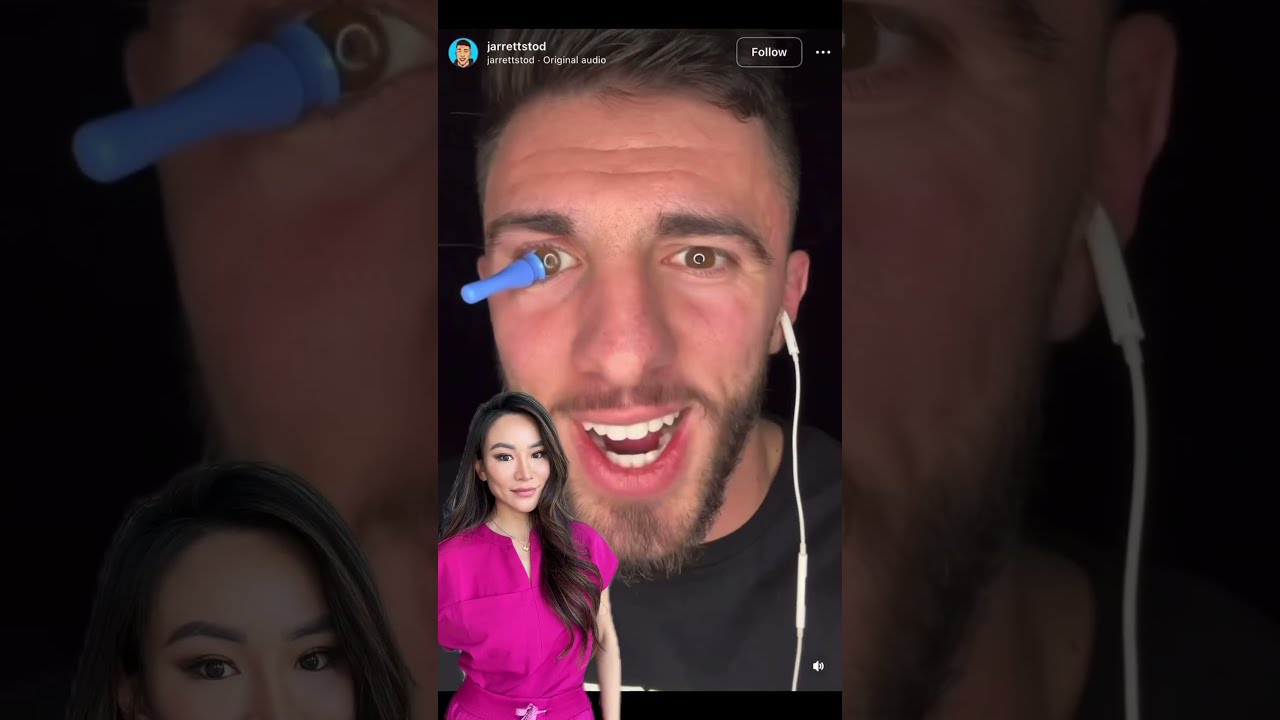 Wearing A Prosthetic Eye Health Eyes Viral Contactlenses Trending