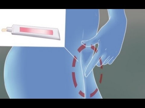 ¿Puedes usar vagicaine con una infección de levadura?