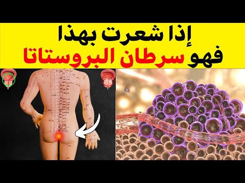 لا تتجاهل هذه الأعراض ال8 قد تنقذ حياتك من سرطان البروستاتا أخطر 8 أعراض صامتة لسرطان البروستاتا