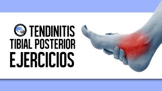 Tendinitis del tibial posterior, tratamiento y ejercicios