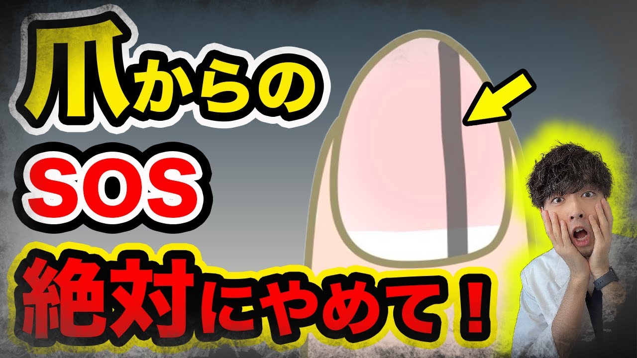 【17%で癌】必ずチェックして！見逃すと危険な６つの「爪」のタイプ【医師解説】