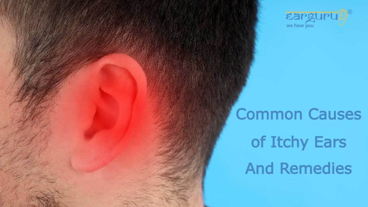 Common Causes And Remedies For Itchy Ears Youtube