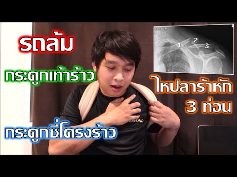 รถล้มหนักขนาดนี้ จะกลับมาขี่บิ๊กไบค์ได้อีกหรือเปล่า