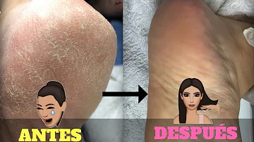 ¿Cómo puedo mantener los talones suaves después de la pedicura?