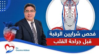 أهمية فحص شرايين الرقبة قبل جراحة القلب | تحضير المريض لجراحة القلب | دكتور اسامة عباس