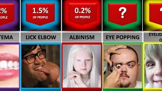 Comparison: Unusual Body Abilities