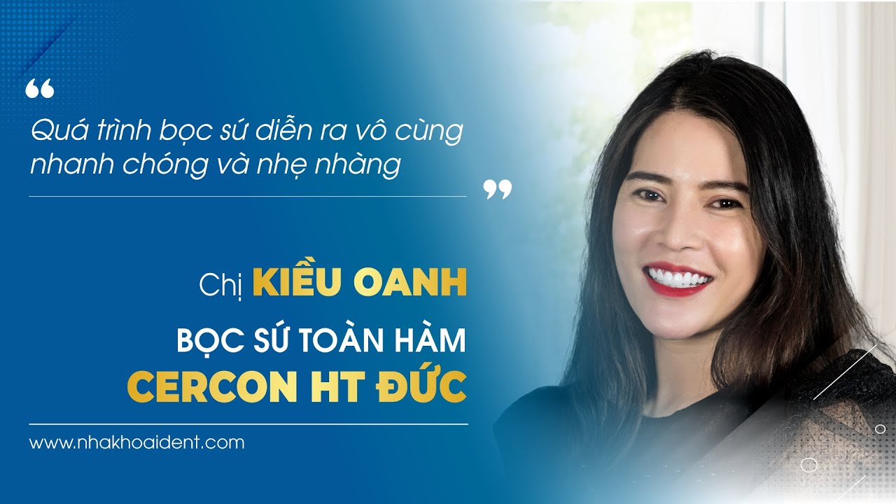 Nâng cấp nụ cười sau khi bọc 20 răng sứ Zirconia tại I-DENT