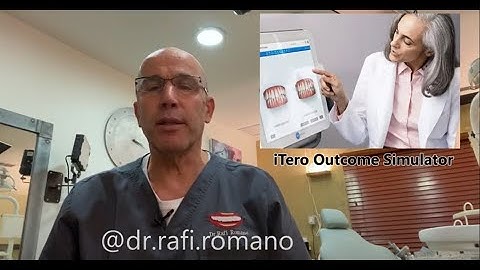Dr. Rafi Romano-Invisalign & iTero Outcome Simulator