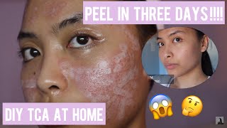 FIRST TIME DIY TCA 50% | DEMO&REVIEW | NO HYPERPIGMENTATION ‼️ | Feat. Banisher 2.0 | screenshot 3