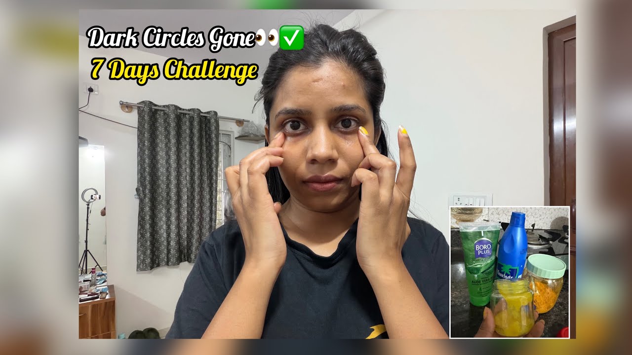 Dark Circles Hatane Ka 7 Days Challenge 👀💆‍♀️ | Honest Result ✨ |thelifeofdivii