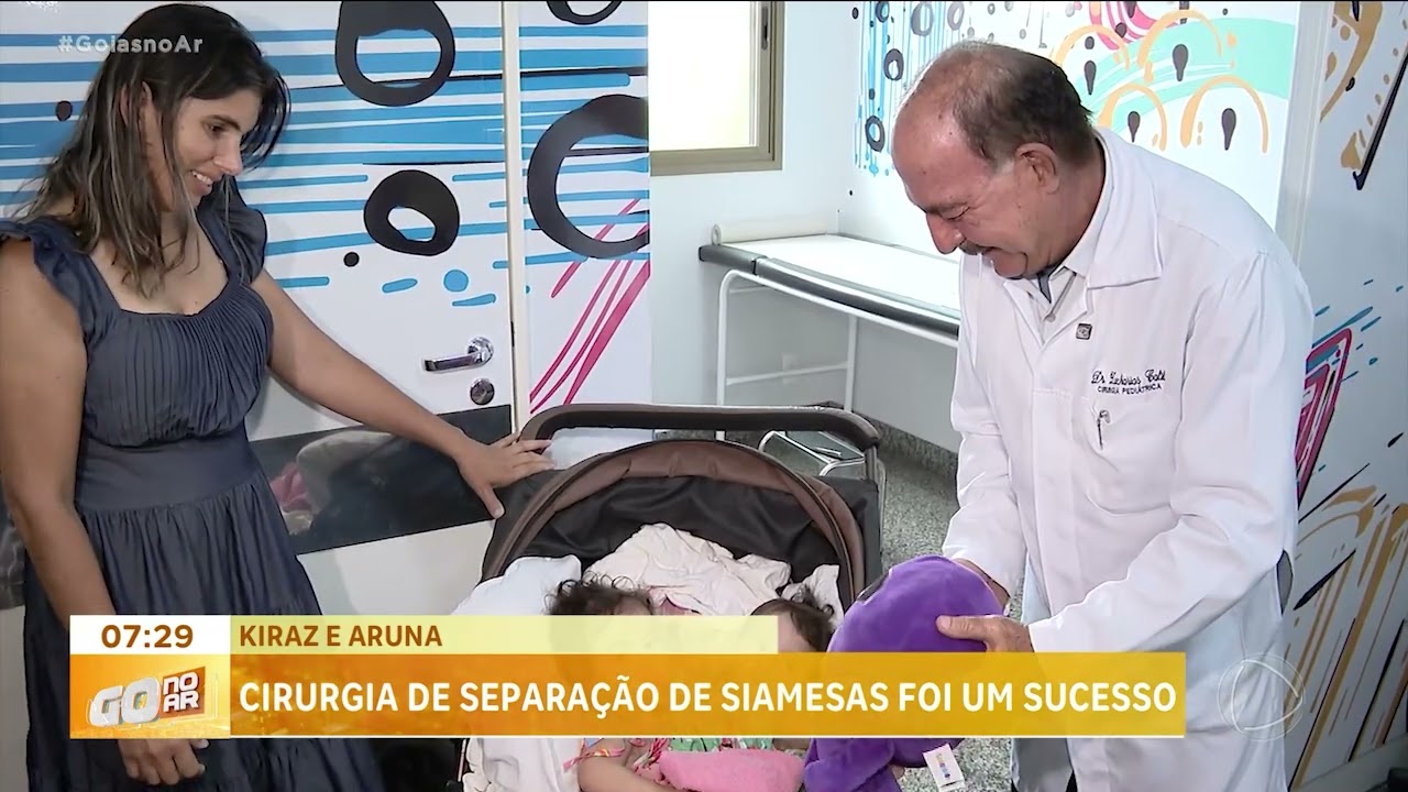 Cirurgia de separação de siamesas foi um sucesso