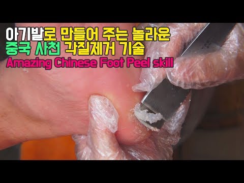 Amazing Chinese Foot Peel skill 아기발로 만들어 주는 놀라운 중국 사천 각질제거 기술, sichuan, CHINA