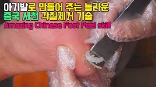 Amazing Chinese Foot Peel skill 아기발로 만들어 주는 놀라운 중국 사천 각질제거 기술, sichuan, CHINA