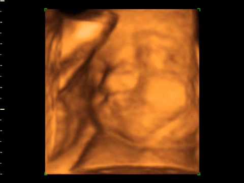 3D 4D Ultrasound baby scan. Window to the Womb Ltd - YouTube