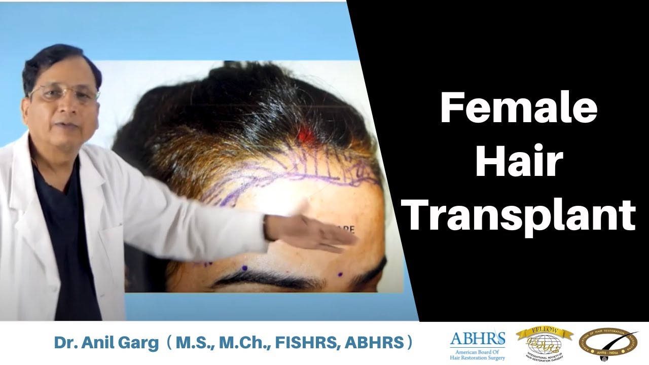 What is the average cost of a hair transplant in Pune? - Nuleaf Hair  Transplant Centre, Pune