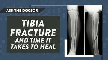 Ask the Doctor: Tibia fracture and time it takes to heal