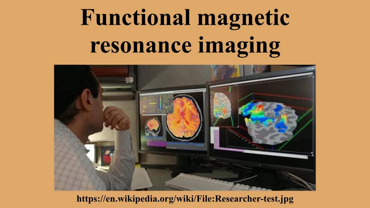Functional magnetic resonance imaging