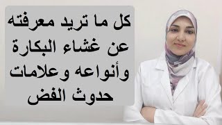 كل ما تريد معرفته عن غشاء البكارة