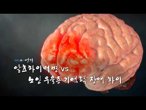 60 Alzheimer’s vs. Senile Depression: Differences in Memory Impairment (Korea University Medical ...