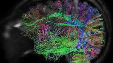 Want to Upload Your Brain? Science Fiction Comes to Life