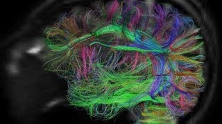 Want to Upload Your Brain? Science Fiction Comes to Life