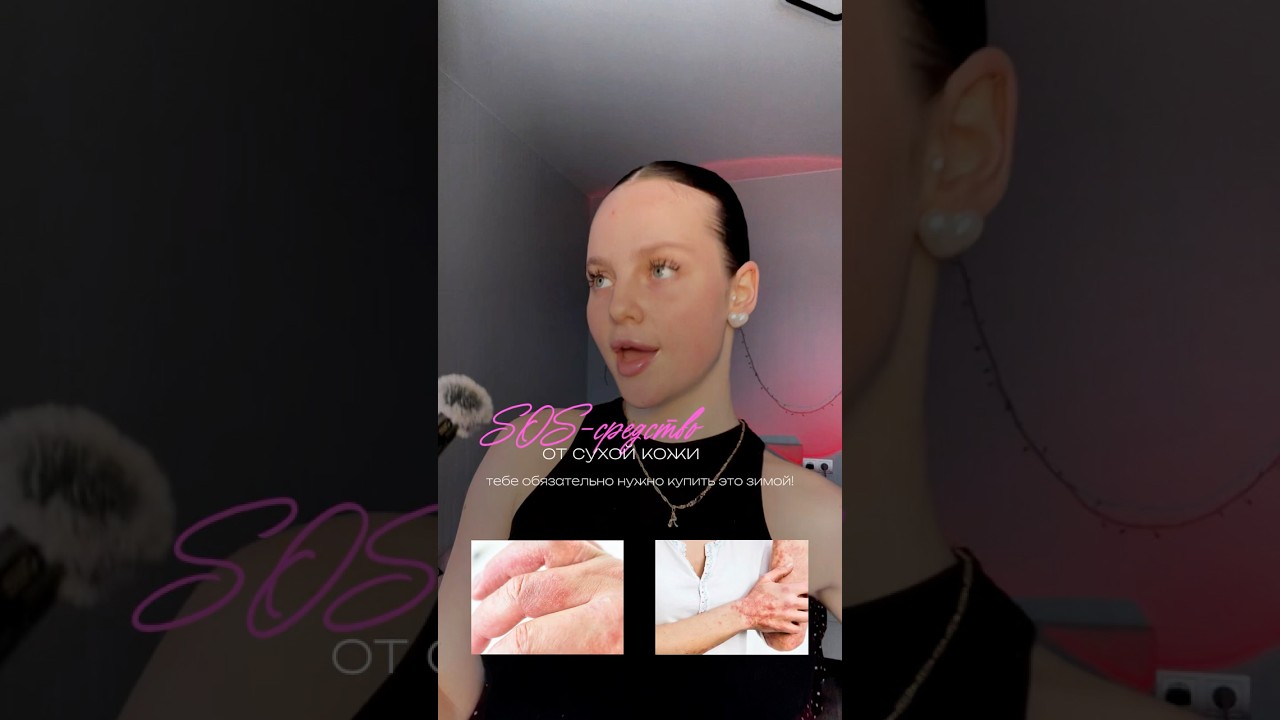 SOS-средство от сухой кожи тебе обязательно нужно купить это зимой!