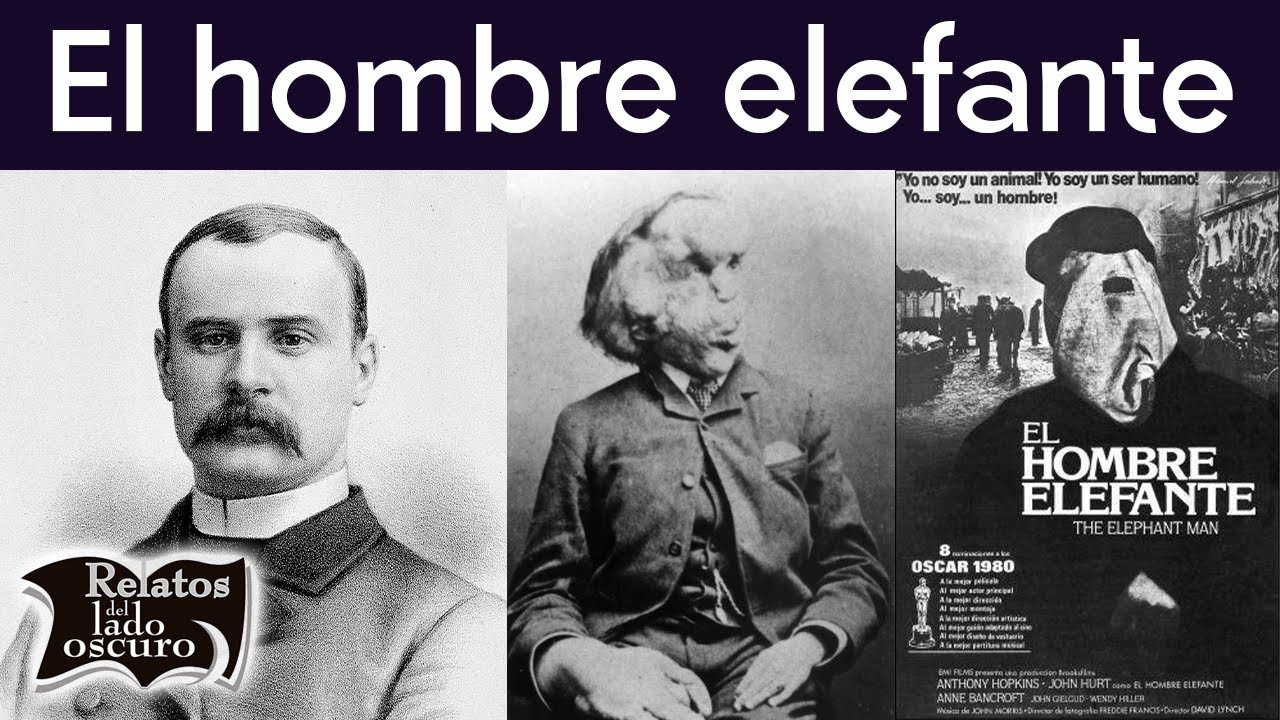El hombre elefante | Relatos del lado oscuro