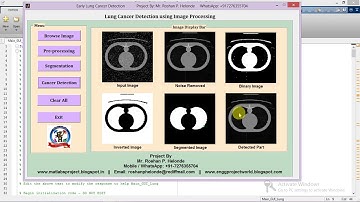 Lung Cancer Detection Using Matlab Project Code