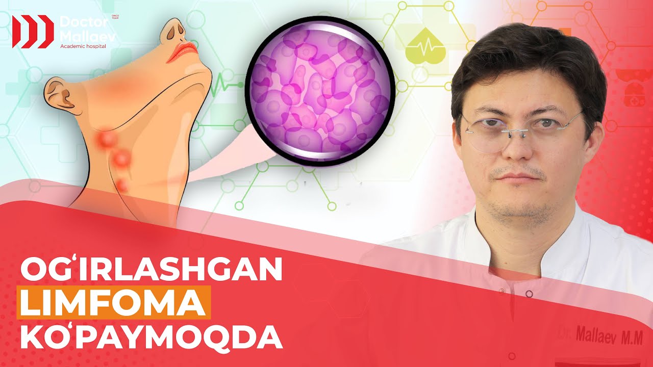 Limfomaning ogʻir holatda uchrashi kuzatilmoqda