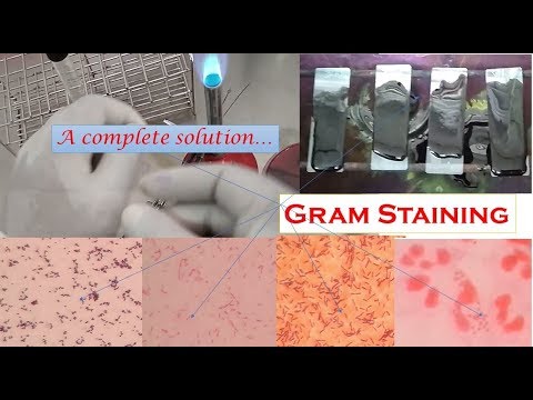 Gram Stain: introduction, procedure and result interpretation