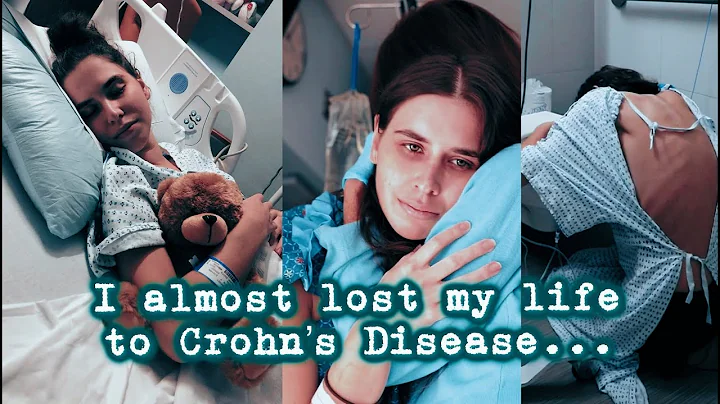 How I Almost Died to Crohns Disease ...