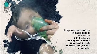 Yemen Can Çekişiyor!