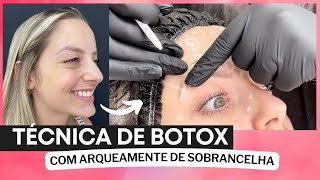 TÉCNICA DE BOTOX PARA NÃO TRAVAR O ROSTO ONDE NÃO DEVERIA