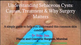 What Is Sebaceous Cyst -Should Your Sebaceous Cyst Be Removed By A Plastic Surgeon? The Benefits