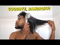 I USED ROYAL OILS FOR 1 MONTH | DANDRUFF WASH DAY