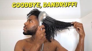I USED ROYAL OILS FOR 1 MONTH | DANDRUFF WASH DAY