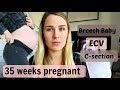 35 weeks pregnant with a breech baby | Breech baby | C- section | ECV