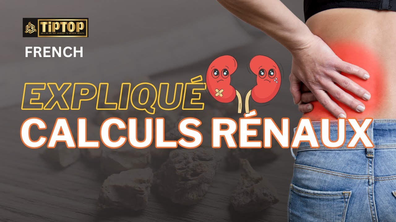 Les calculs rénaux expliqués : causes, symptômes et remèdes naturels
