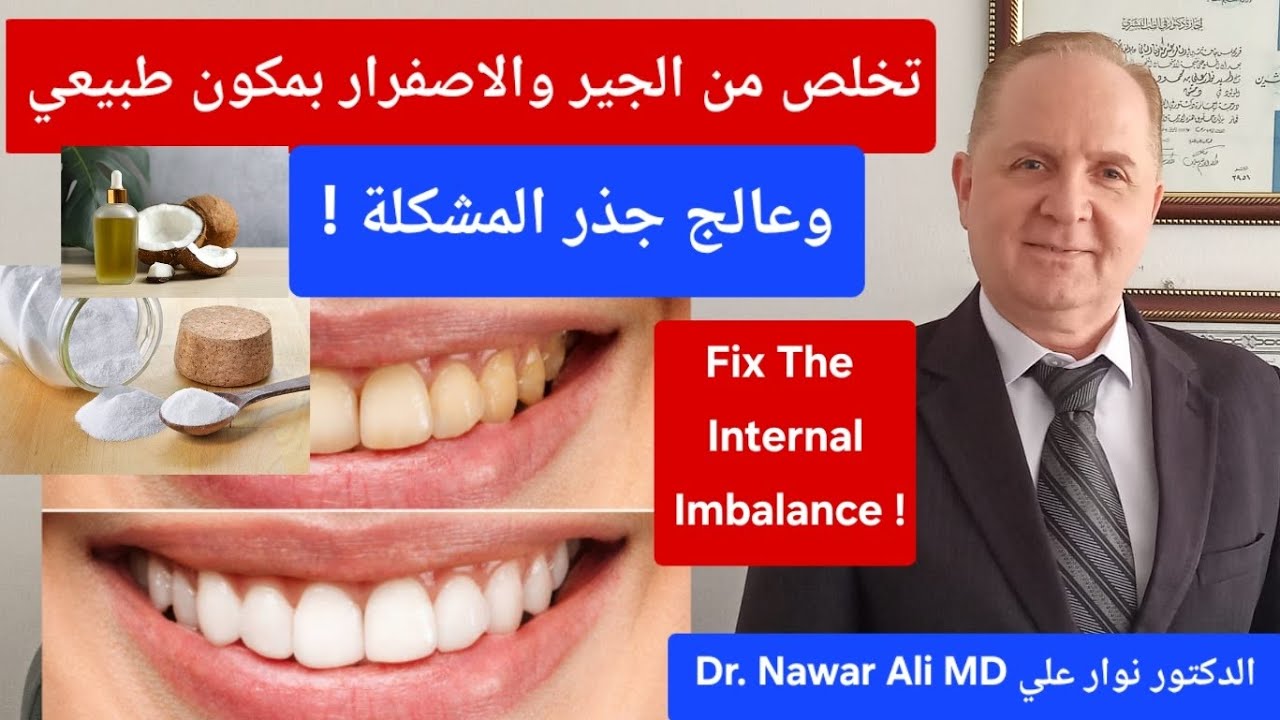 أفضل وصفة على الإطلاق.. تبييض الأسنان والتخلص من الجير بمكونين طبيعيين وأغذية مفيدة لتبييض الأسنان !