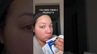 Cystic and hormonal acne must haves #acne #cysticacne #skincare #tretinoin #panoxyl #spironolactone