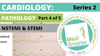 Usmle Step 1 Cardiac Pathology Medsmarter S2 Part 4 Of 5 Nstemi & Stemi