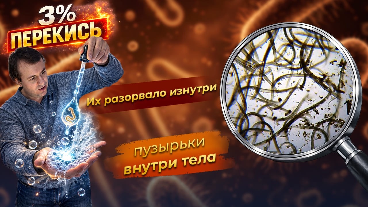 Перекись 3% против нематод — что происходит под микроскопом? ШОК РЕАКЦИЯ